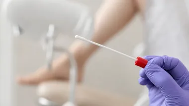 Bezpłatne badanie HPV HR w Kielcach. Sprawdź, kto może skorzystać