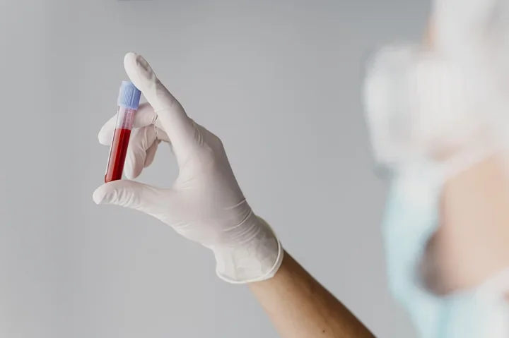 W Kielcach brakuje krwi. RCKiK otworzy punkt także w sobotę