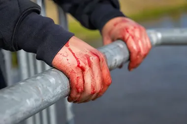 Zakrwawione dłonie osoby w ciemnej bluzie opierają się na metalowej barierce na zewnątrz.